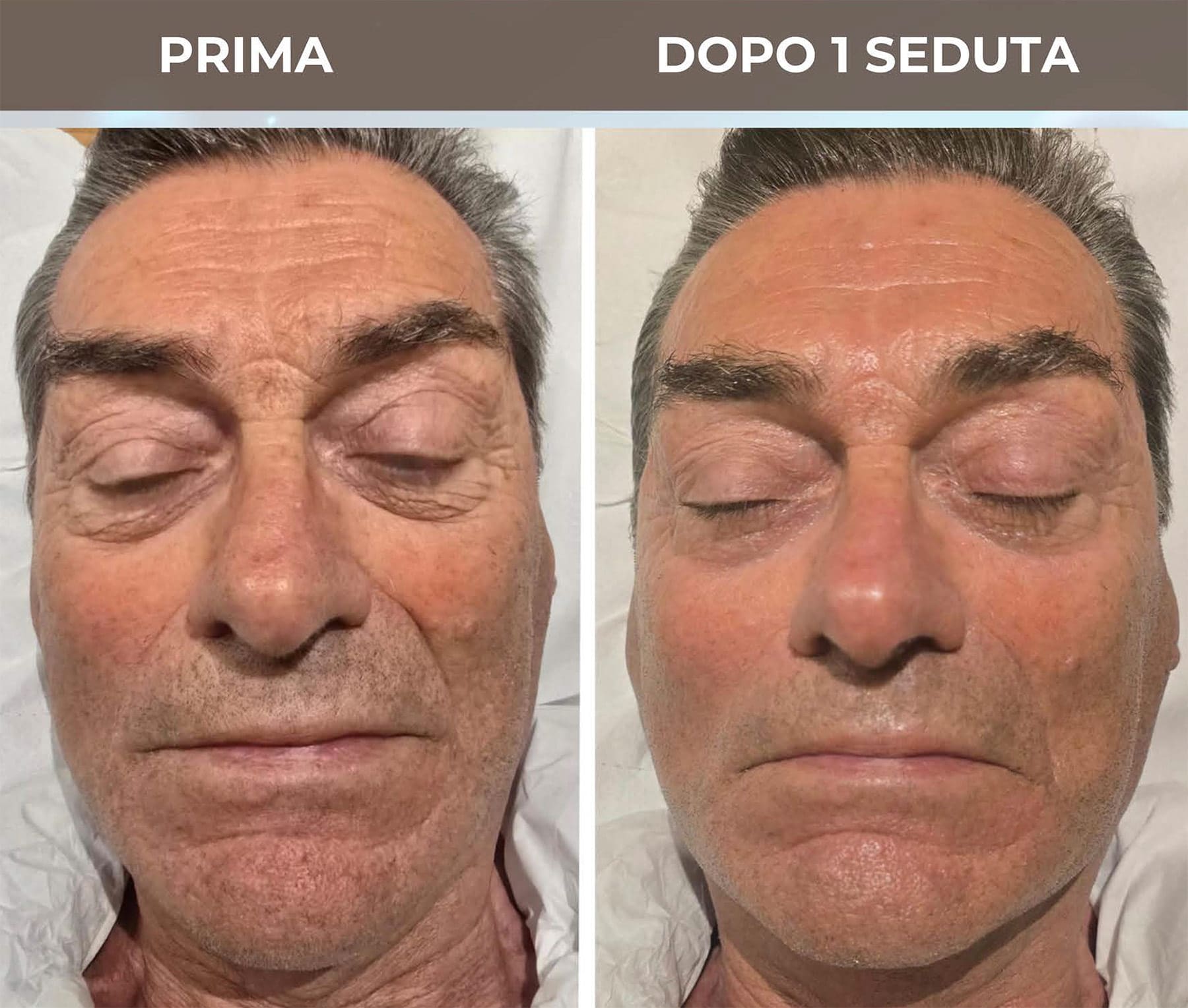 Trattamento Skincare a Roma